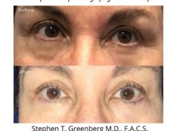 Greenberg Cosmetic Surgery And Dermatology Excellence Awaits