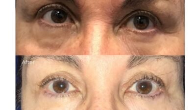 Greenberg Cosmetic Surgery - Woodbury - Woodbury, New York - Realself