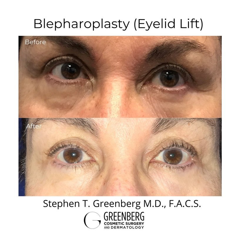 Greenberg Cosmetic Surgery - Woodbury - Woodbury, New York - Realself Greenberg Cosmetic Surgery - Woodbury - Woodbury, New York - Realself